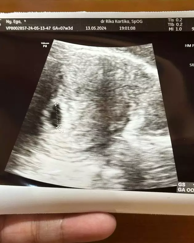 Ega Noviantika kehamilan ketiga © Instagram