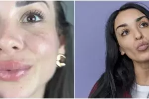 Hasilnya langsung terlihat, wanita ini bagikan cara bikin bibir merah alami hanya pakai 3 bahan dapur