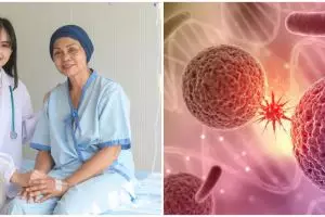Apa itu kanker Sarkoma? Kenali gejala, penyebab, dan cara mengatasinya