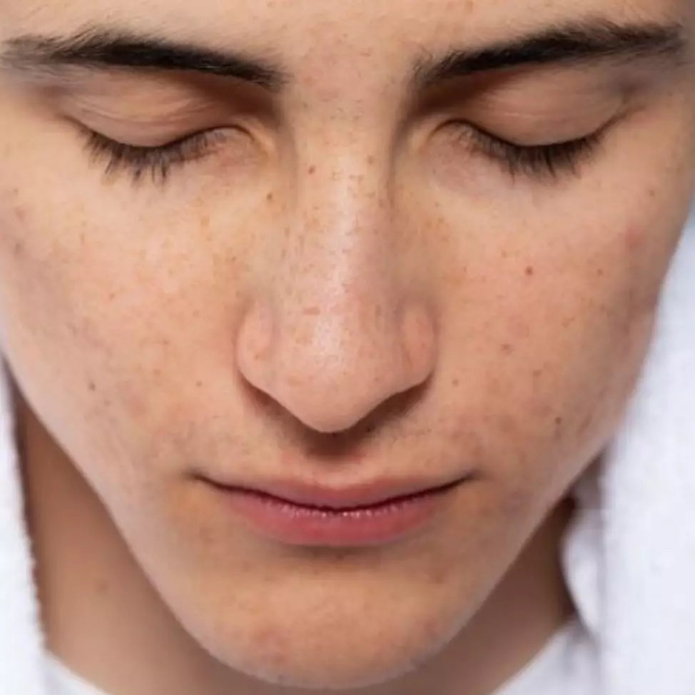 Tak cuma pakai kunyit, ini cara bikin face serum pudarkan flek hitam dengan tambahan 1 bahan alami