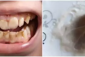 Tanpa treatment whitening, ini cara putihkan gigi berplak dan bernoda kuning cuma pakai 2 bahan dapur
