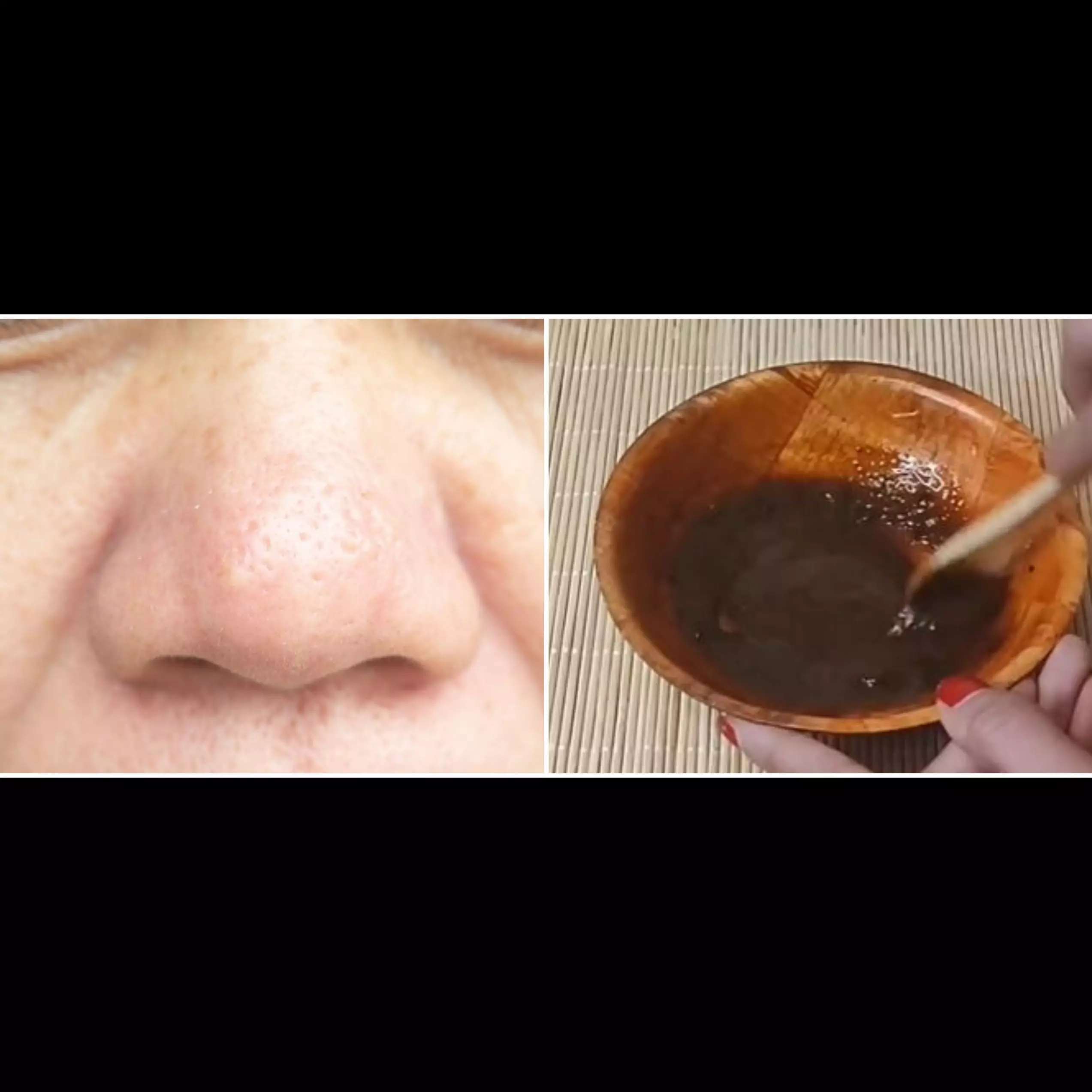 Tanpa beli scrub mahal, TikToker ini bagikan cara rapatkan pori-pori besar pakai 2 bahan alami