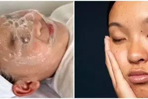 Cara beauty vlogger cerahkan flek hitam pakai 1 tanaman ini bikin geli tapi bikin wajah auto glowing