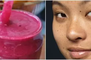 Tanpa aplikasikan produk skincare, wanita ini bagikan cara cerahkan flek hitam andalkan 1 jenis sayur