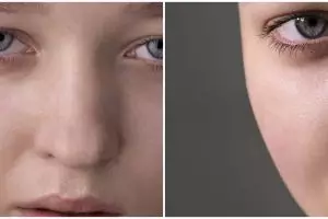 Bukan cuma moisturizer, cara lembapkan wajah dehidrasi ini pakai tambahan 1 jenis kapsul