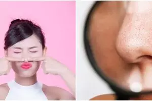Tanpa pakai clay mask, wanita ini bagikan cara hilangkan komedo cuma pakai 1 jenis minyak