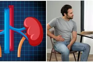 8 Kelompok ini rentan terkena batu ginjal, intip risiko dan cara pencegahannya