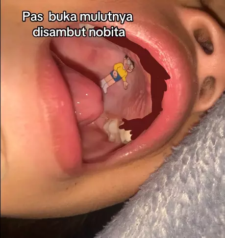 mulut anaknya © TikTok