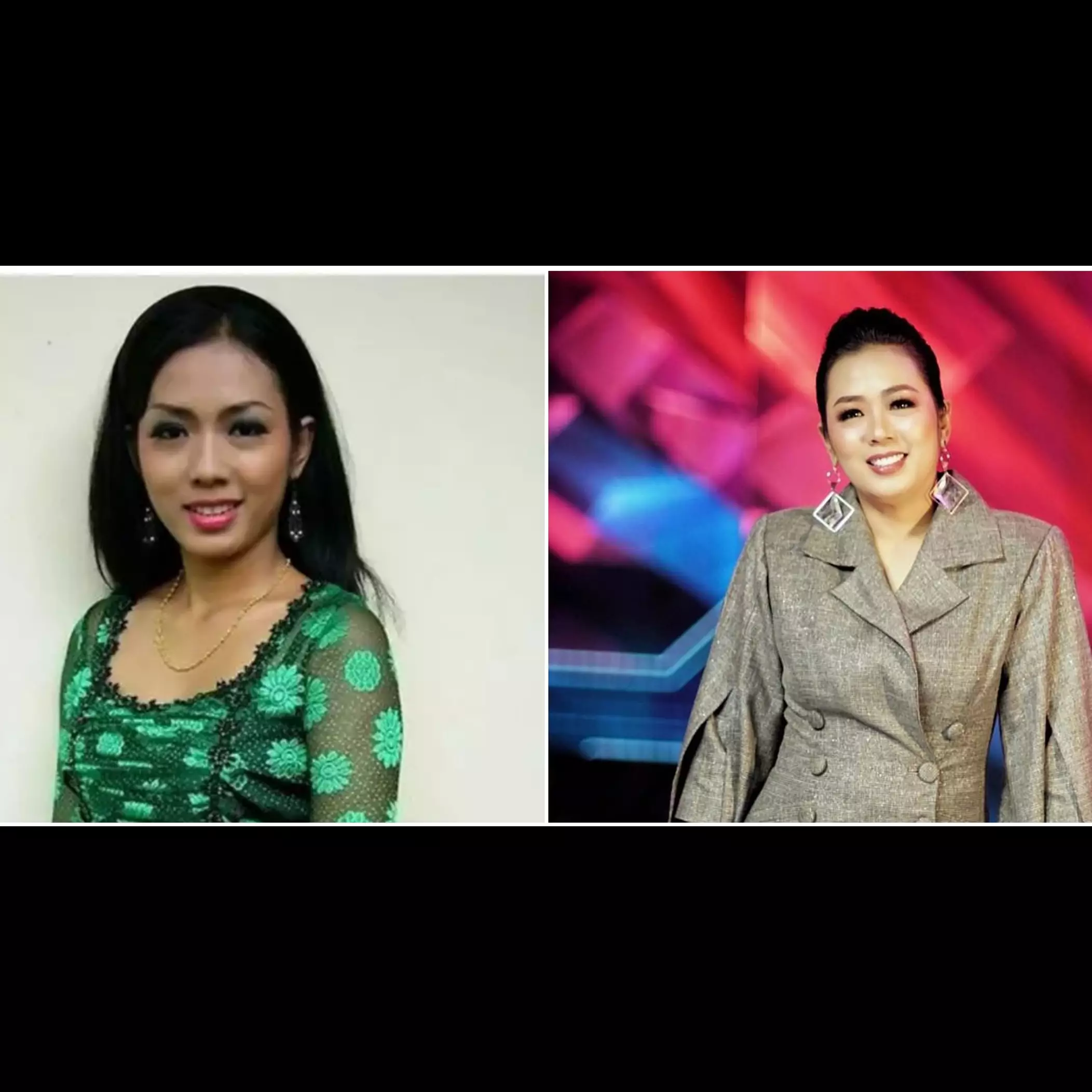 Rela habiskan uang puluhan juta rupiah, ini 7 potret penyanyi sebelum dan sesudah veneer gigi