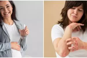 Waspada cacar air selama kehamilan, kenali risiko, pencegahan, dan cara pengobatannya