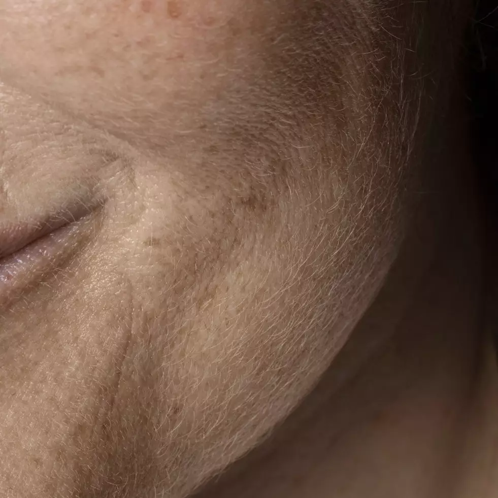 Jadi halus dan bebas pecah-pecah, ini cara atasi kulit kering pakai body lotion dicampur 1 produk