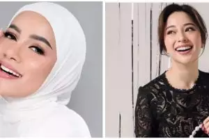 Jadi andalan artis demi punya senyum menawan, ini jenis, efek samping, dan harga treatment veneer gigi
