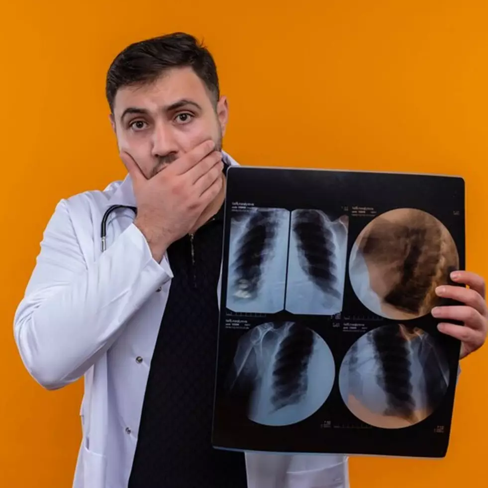 Perokok pasif berisiko kanker paru-paru, kenali bahaya asap rokok, dampak, dan cara mencegahnya