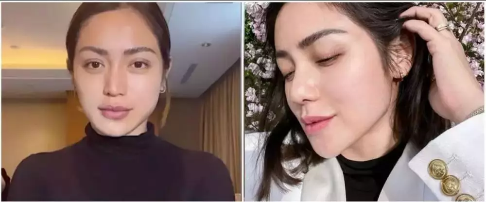 Seleb pilih oplas meski sudah cantik alami Berbagai sumber Seleb pilih oplas meski sudah cantik alami Berbagai sumber