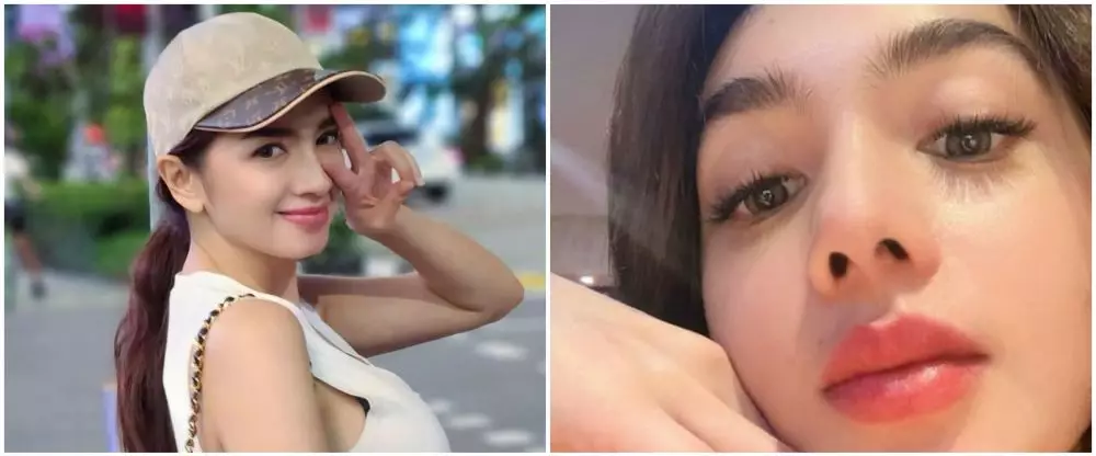 Seleb pilih oplas meski sudah cantik alami Berbagai sumber Seleb pilih oplas meski sudah cantik alami Berbagai sumber