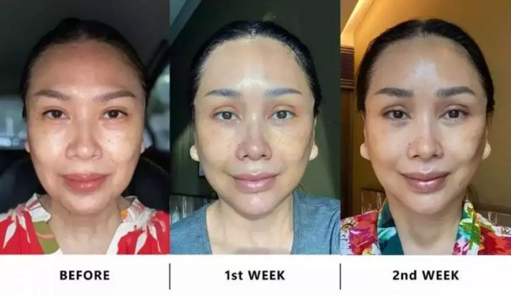 Seleb pilih oplas meski sudah cantik alami Berbagai sumber Seleb pilih oplas meski sudah cantik alami Berbagai sumber