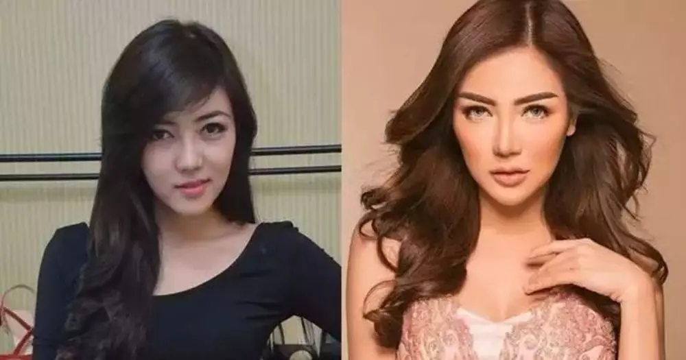 Seleb pilih oplas meski sudah cantik alami Berbagai sumber Seleb pilih oplas meski sudah cantik alami Berbagai sumber