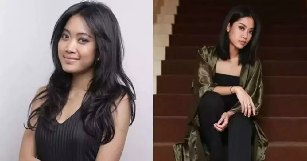 Seleb pilih oplas meski sudah cantik alami Berbagai sumber Seleb pilih oplas meski sudah cantik alami Berbagai sumber