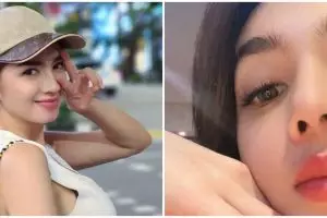 11 Seleb ini pilih oplas meski sudah cantik alami, ini potret sebelum dan sesudahnya