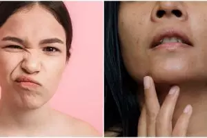 Tanpa whitening cream, ini cara cerahkan wajah kusam pakai masker salicylic acid dari 1 jenis tepung