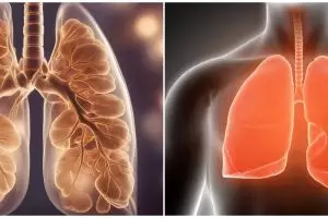 7 Olahraga terbaik untuk meningkatkan kapasitas paru-paru, bantu jaga kebugaran tubuh lebih optimal