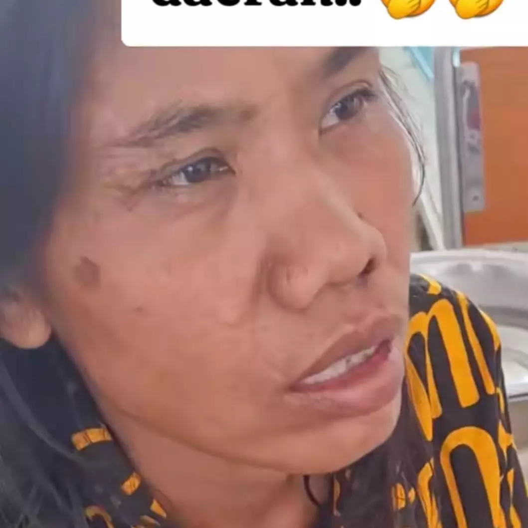 Cerita dokter THT dinas di kampung, obati pasien yang mimisan 2 minggu, usai diperiksa ada hewan ini