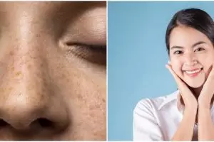 Tanpa lemon, ini cara pudarkan flek hitam akibat penuaan pakai buah bit dicampur 1 bahan makanan