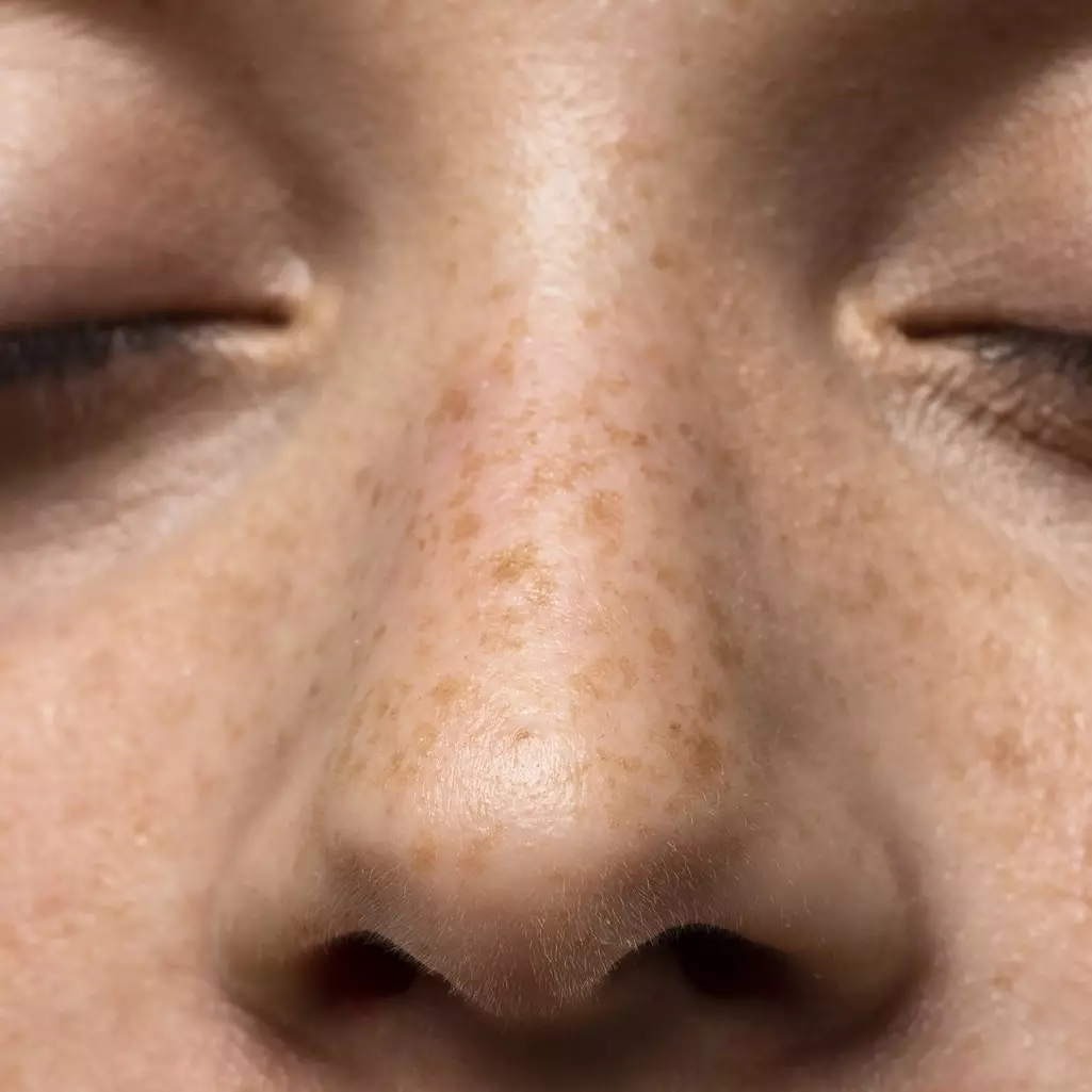 Tanpa lemon, ini cara pudarkan flek hitam akibat penuaan pakai buah bit dicampur 1 bahan makanan