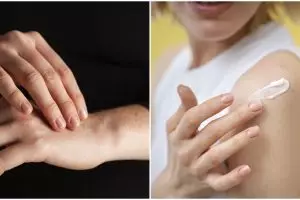 Kulit putih merata, cewek ini bagikan racikan atasi tangan belang pakai lotion dicampur 1 jenis bubuk