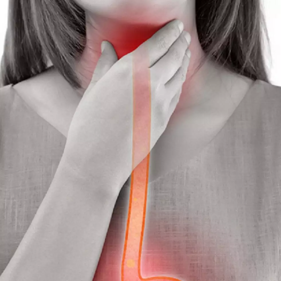 9 Komplikasi yang disebabkan karena asam lambung, ubah gaya hidup demi kesehatan jangka panjang