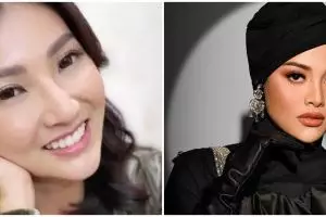 Sudah cantik dengan bibir alami, perubahan 7 penyanyi sebelum & sesudah filler bibir ini auto seksi