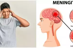 Dapat sebabkan kerusakan otak, kenali bahaya meningitis: gejala, penyebab, dan cara pencegahannya