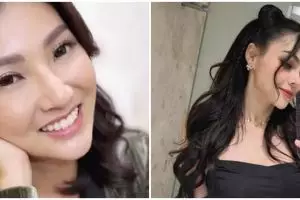 Makin cantik dengan wajah tirus, ini 11 potret seleb sebelum dan sesudah lakukan filler dagu
