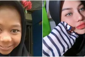 Lakukan facial hingga oplas hidung, ini 7 potret perubahan wajah Cimoy dari awal viral sampai lamaran