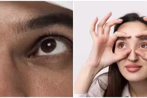 Tanpa gunakan eye cream, wanita ini bagikan cara atasi mata panda pakai 1 bubuk minuman