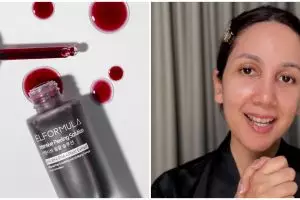 Review serum Elformula Intensive Peeling Solution, Suhay Salim: diklaim nggak bikin iritasi