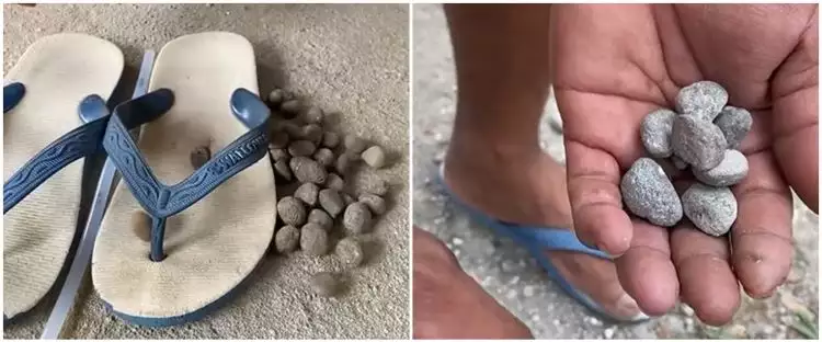 Nggak perlu beli, lifehack nyeleneh cara bikin sandal rematik ini gampang cuma modal batu jalanan