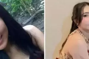 Potret perubahan wajah 9 penyanyi setelah treatment hidung, Mawar AFI sampai habiskan ratusan juta