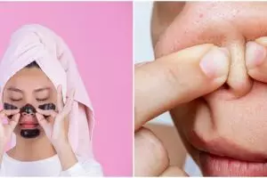 Bukan cuma madu, wanita ini bagikan trik hilangkan komedo pakai 1 jenis rempah