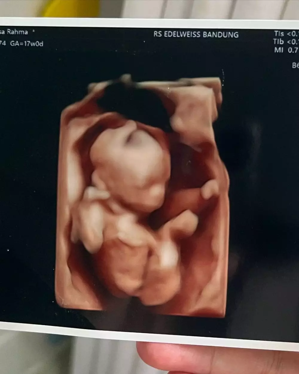 anak ketiga anisa rahma © 2024 Instagram anak ketiga anisa rahma © 2024 Instagram