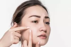 Tak perlu facial mahal, ini trik hilangkan komedo di wajah pakai 1 jenis penjepit rambut