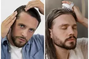 Tanpa pakai santan, pria ini bagikan cara atasi kerontokan berlebih dengan hair oil dari 2 bumbu dapur