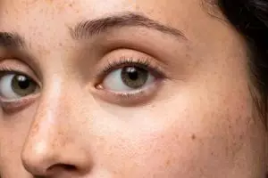 Tanpa serum vitamin C, kombinasi bedak bayi dan lemon ini bikin wajah cerah merata bebas flek hitam