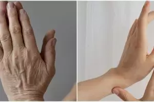 Tanpa dicampur lemon dan kuning telur, ini cara atasi kerutan pada tangan pakai 1 ampas buah