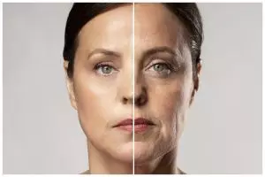 Tanpa serum antiaging, ini cara cegah tanda penuaan di wajah pakai masker botoks dari 3 bahan alami