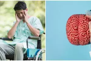 Penyakit radang otak jadi isu hangat, kenali penyebab, gejala, dan cara mengatasinya