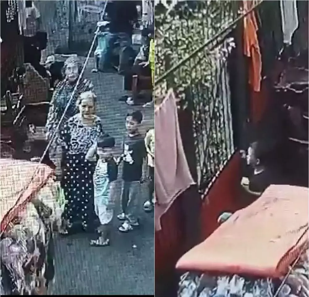 bocah digigit anjing hingga putus syaraf air mata Twitter