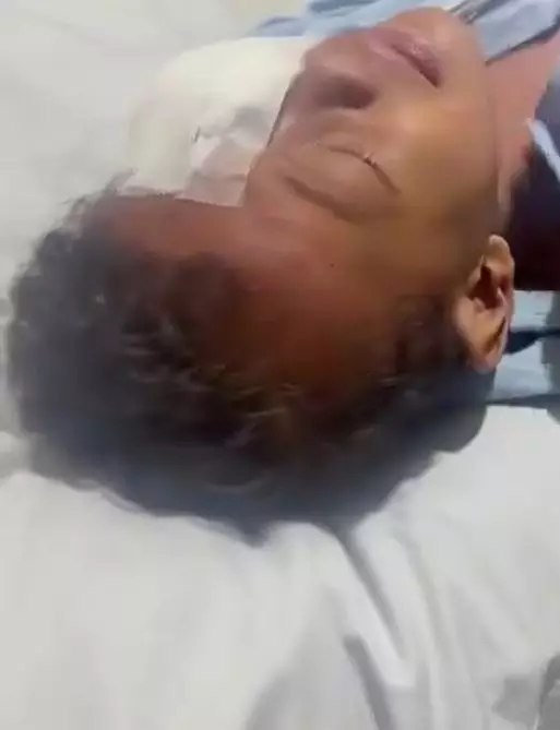 bocah digigit anjing hingga putus syaraf air mata Twitter