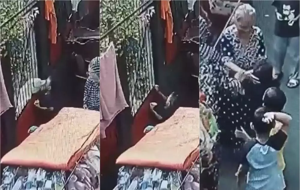 bocah digigit anjing hingga putus syaraf air mata Twitter