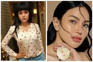 Habiskan duit Rp1 M untuk permak wajah, ini 9 potret sebelum & sesudah Nikita Mirzani perawatan wajah